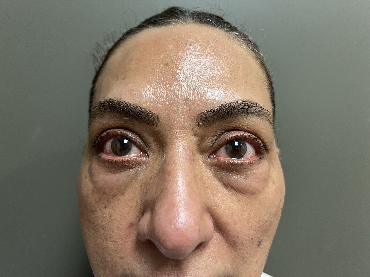 Close-up of a person's eyes and face.