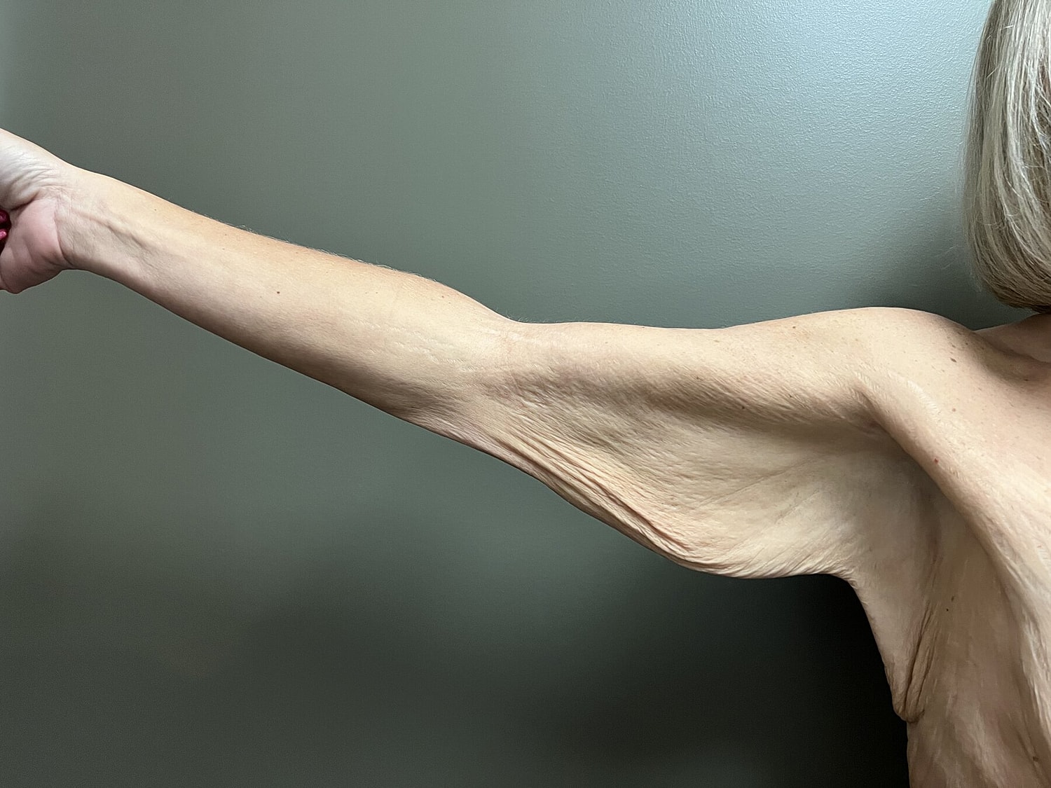 Outstretched arm with visible skin texture.